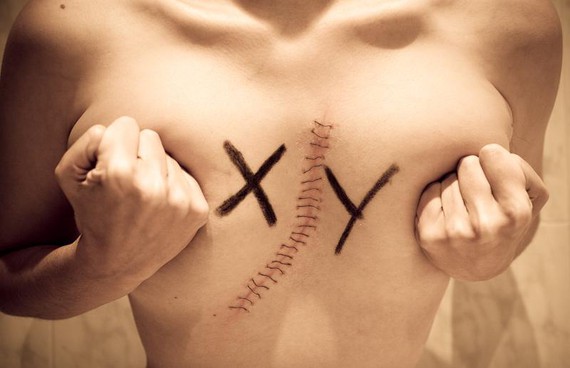 Alemaniak "hirugarren sexua" onar dezake azaroan