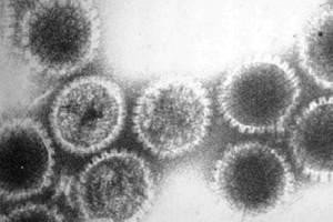 Herpes birusaren eta alzheimerraren arteko lotura