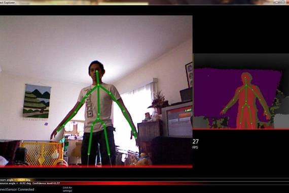 Bideo-joko teknologia Parkinsonaren diagnostikoan lagintzeko