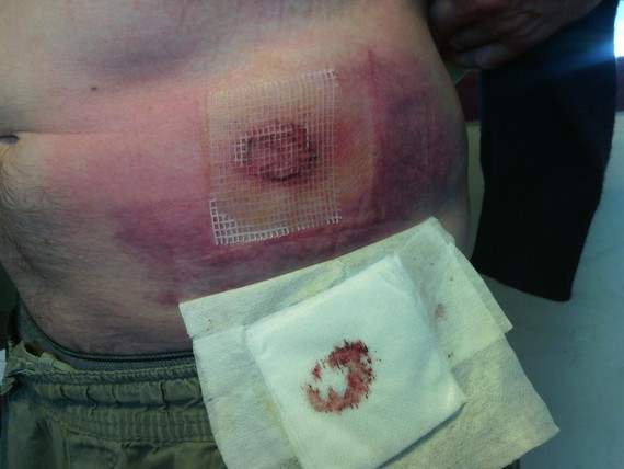 Ortzaizen gertatutakoa dela eta, sustengua eskatu dute Euskal Irratiek