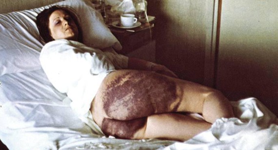 Behar ziren argazkiak